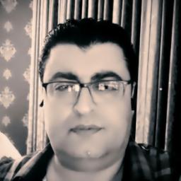 Neden Saçların Beyazlanmış Arkadaş