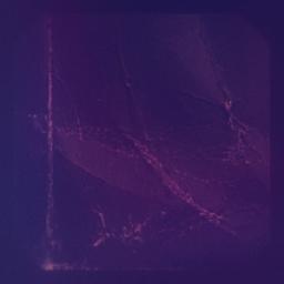 💖 Hatiku Luka Lagi 💖BDB